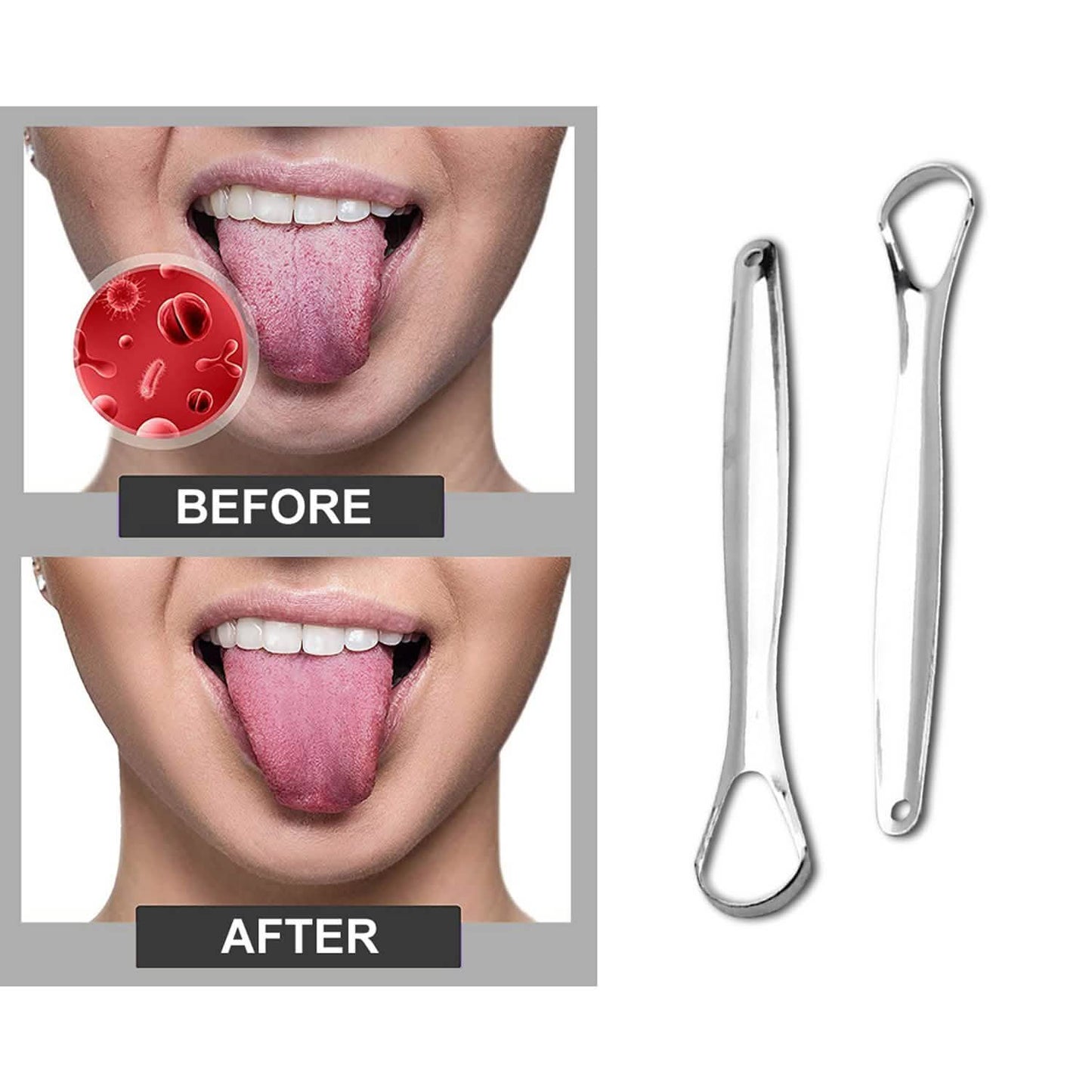 2-Pack: Stainless Steel Tongue Cleaner Scraper