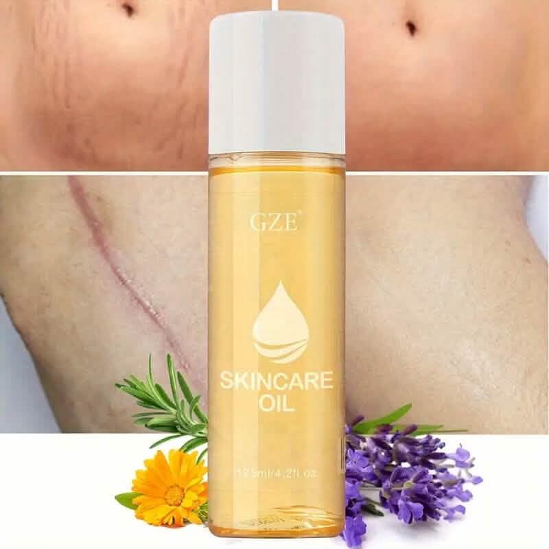 Advanced Stretch Mark Oil with Vitamin E