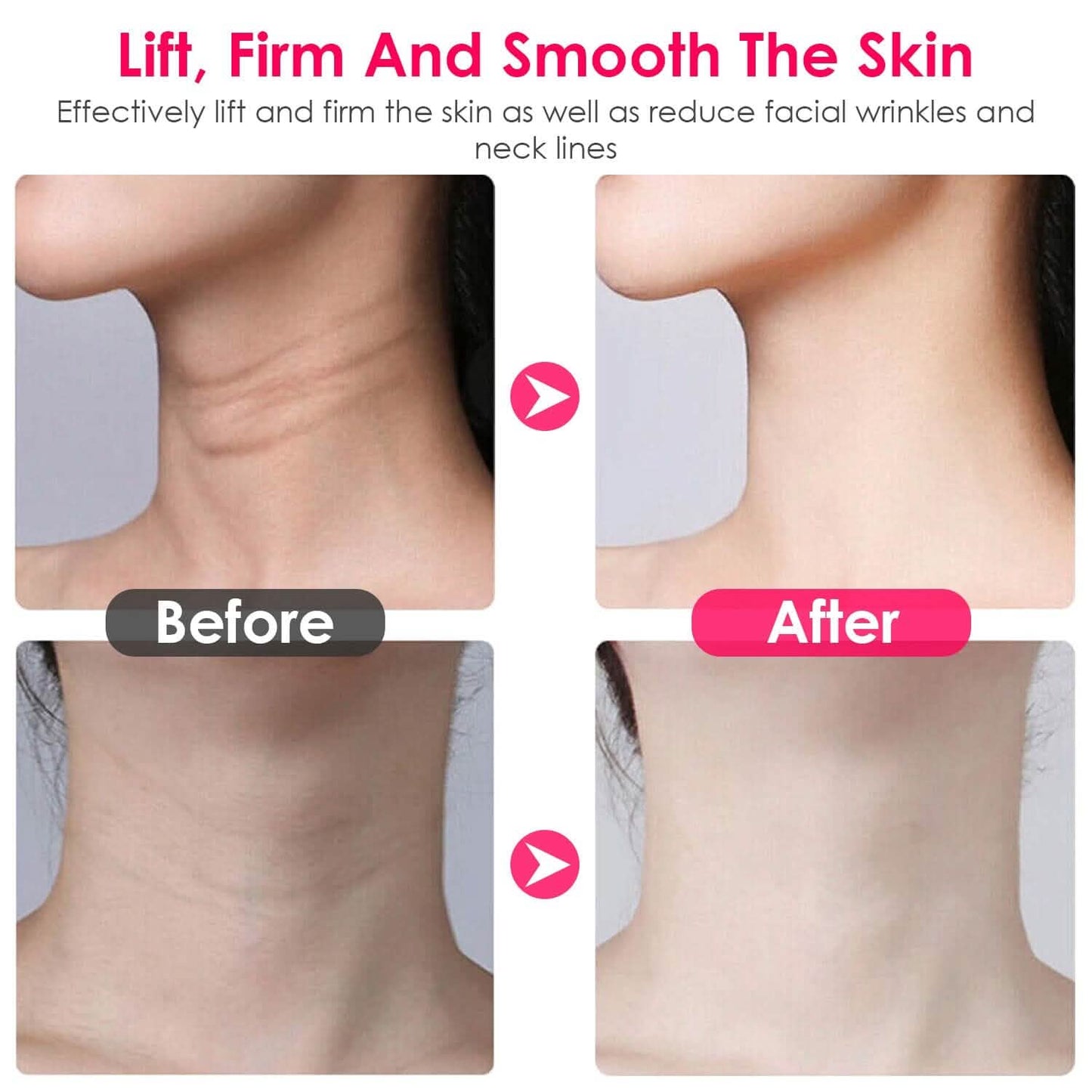 Anti Wrinkles Face Neck Massager Double Chin Reducer