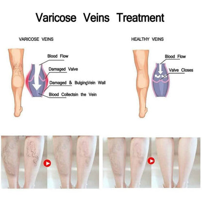 Varicose Deep Nourishing Soothing Vein Cream