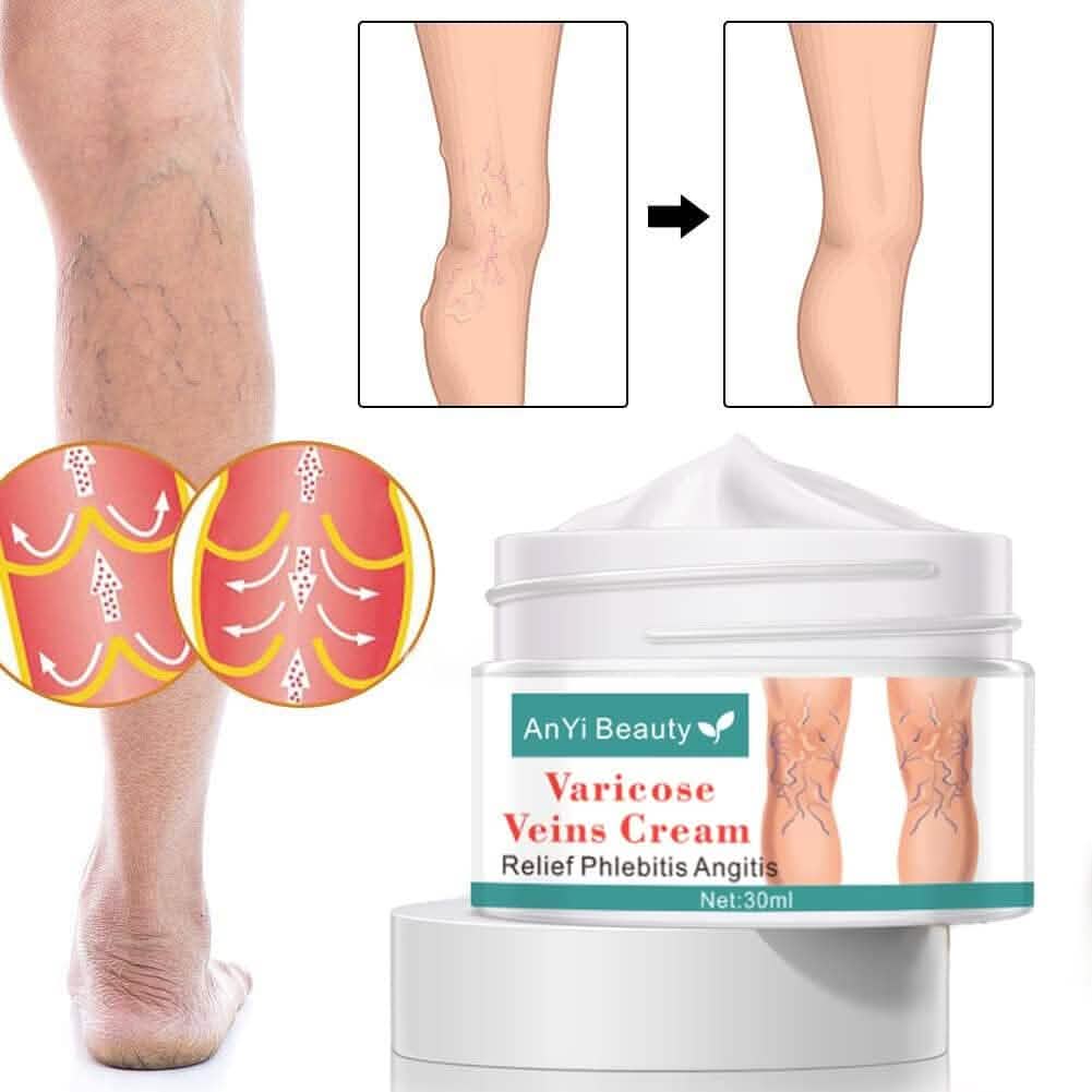 Varicose Deep Nourishing Soothing Vein Cream