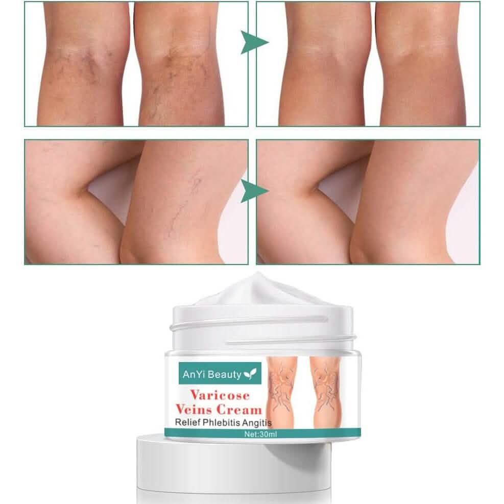 Varicose Deep Nourishing Soothing Vein Cream