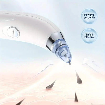 Blackhead Vacuum Remover, Powerful Portable Facial Pore Cleaner With 4 Probes