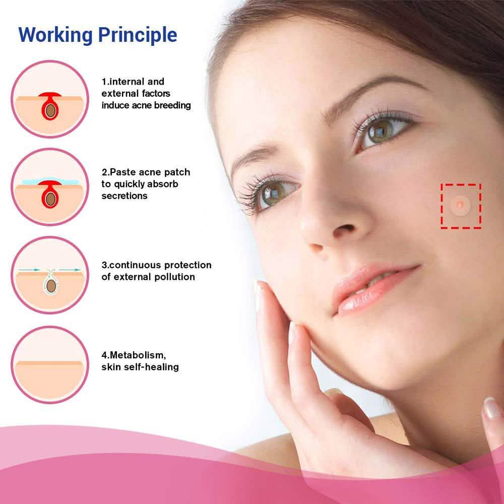 Blemish and Acne Treatment Skin Healing Spot Patches