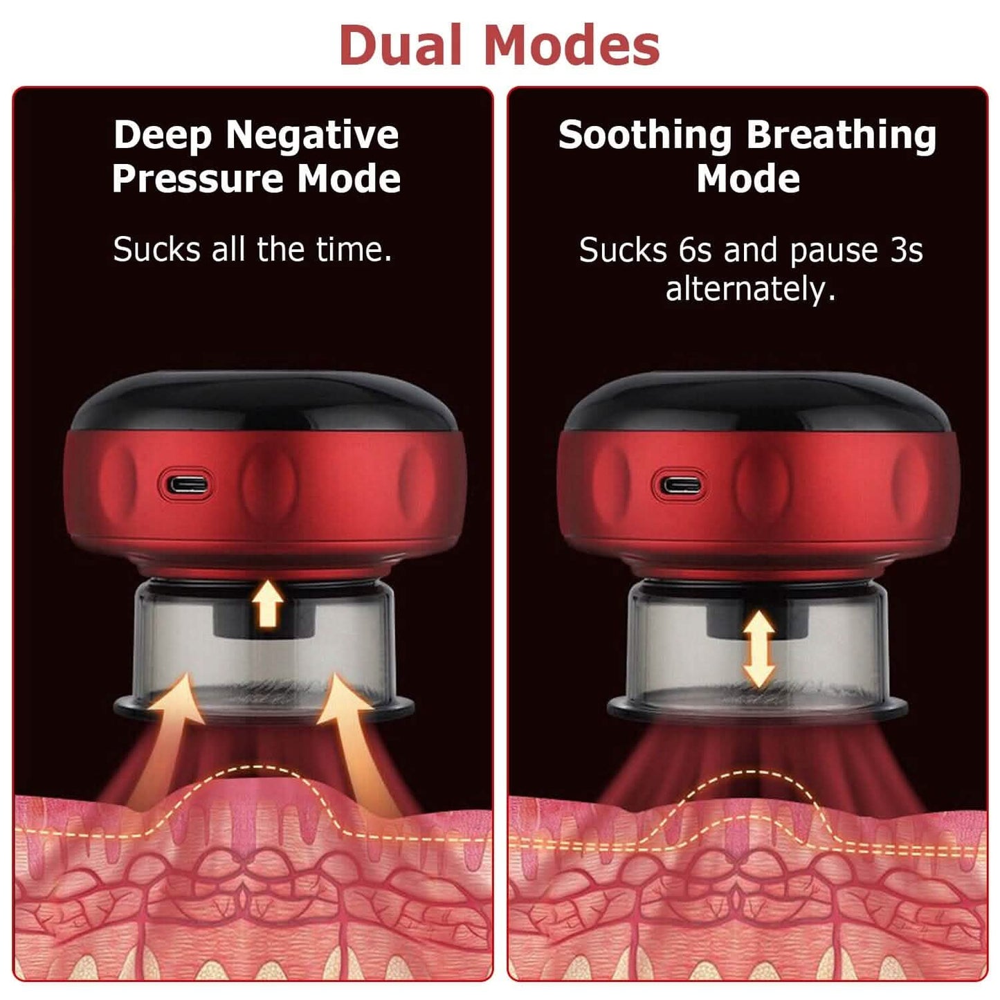 Electric Back Scraping Machine Vacuum Therapy Cupping Device