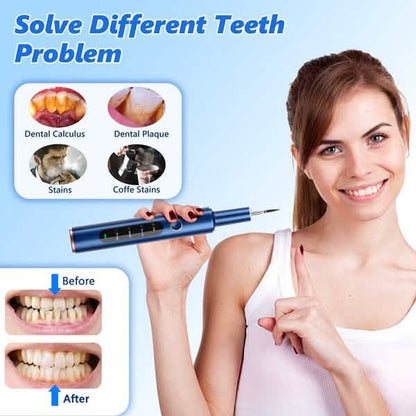 Electric Plaque Remover for Teeth, Rechargeable Teeth Cleaning Kit with 4 Modes