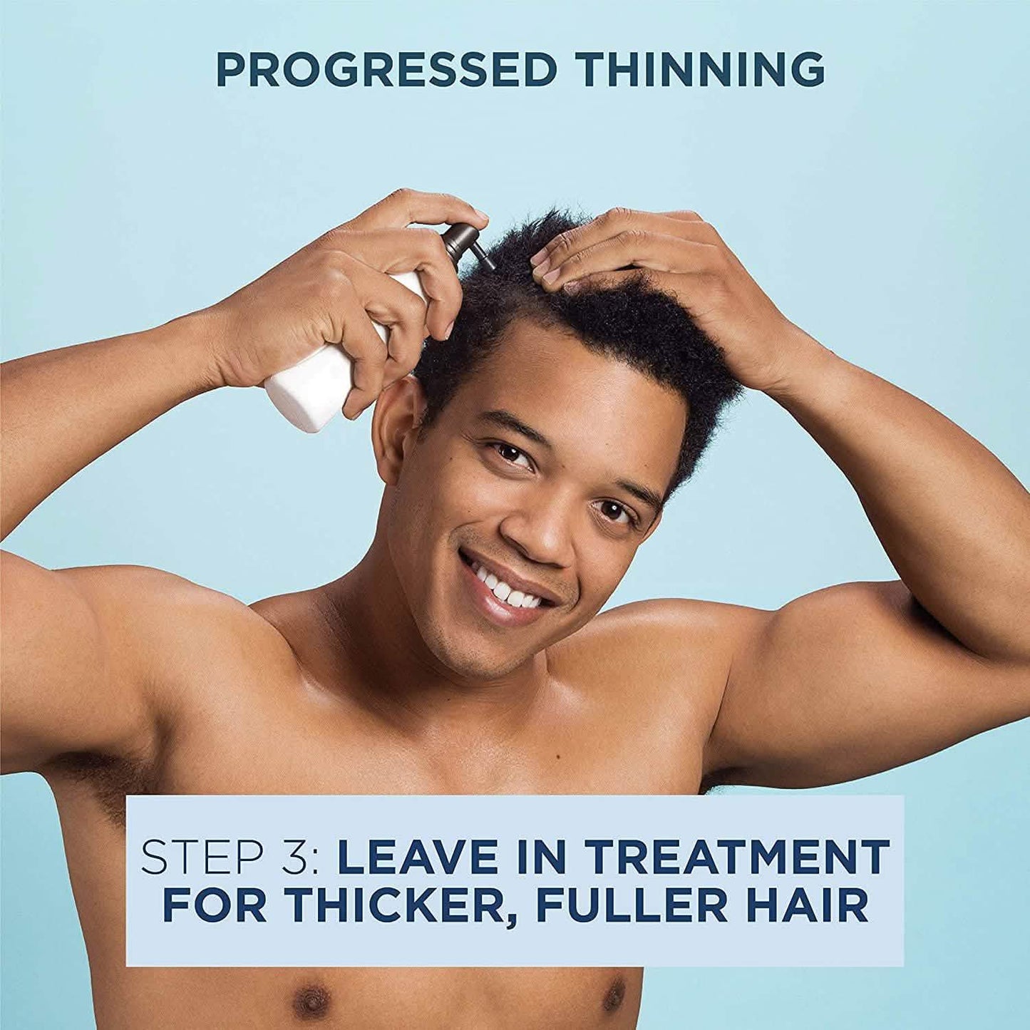Nioxin Full-Size System Kits for Progressed to Advanced Thinning Hair