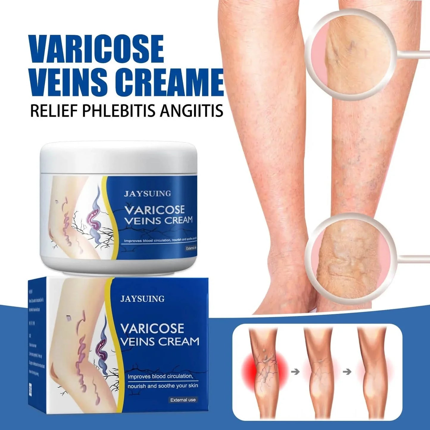 Pain Relief Leg Spider Veins Vasculitis Promote Circulation Smooth Metabolism 30g Exfoliation