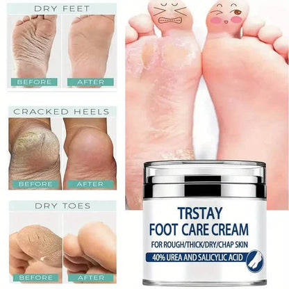Trstay Foot Care Cream50g/ Foot Care Cream 40 Urea And Salicylic Acid