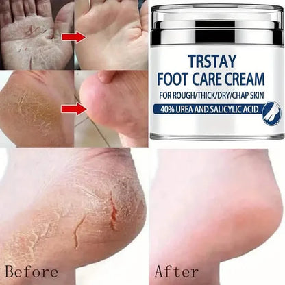 Trstay Foot Care Cream50g/ Foot Care Cream 40 Urea And Salicylic Acid