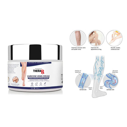 Varicose Veins Cream