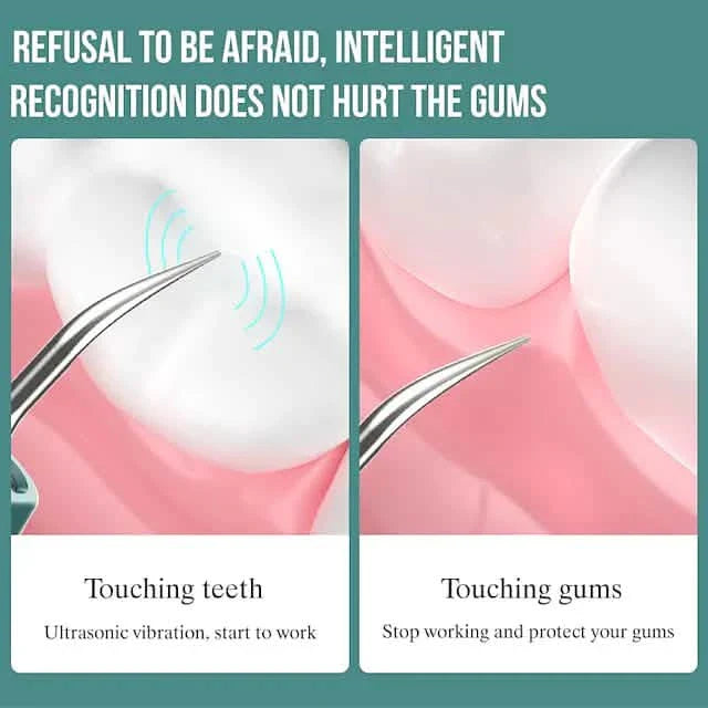 Visual Ultrasonic Teeth Cleaner
